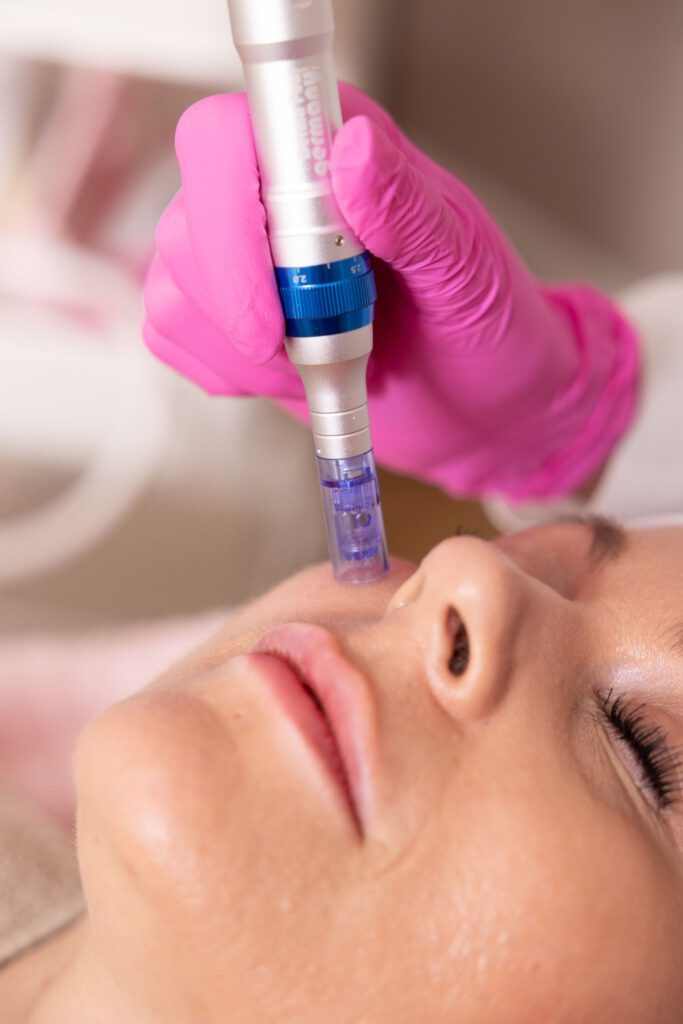 Professioneller Microneedling Behandlung für Anti-Aging, Hautverjüngung, Narbenreduzierung und Porenverfeinerung in der Schönheitsmanufaktur Gilching